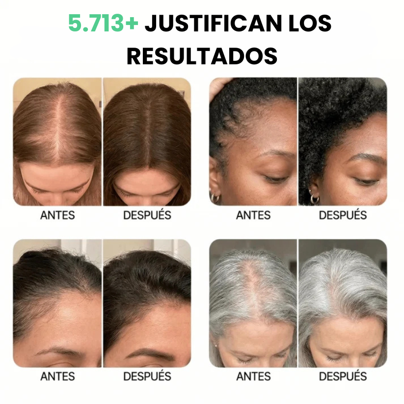 Sérum Capilar Coreano Vellaskim™ · Crecimiento y Densidad